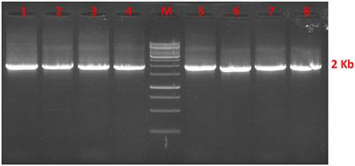 Characterization of Anti-Müllerian Hormone (AMH) Gene in Buffaloes and Goats